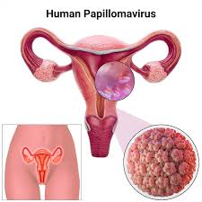 Human Papillomavirus